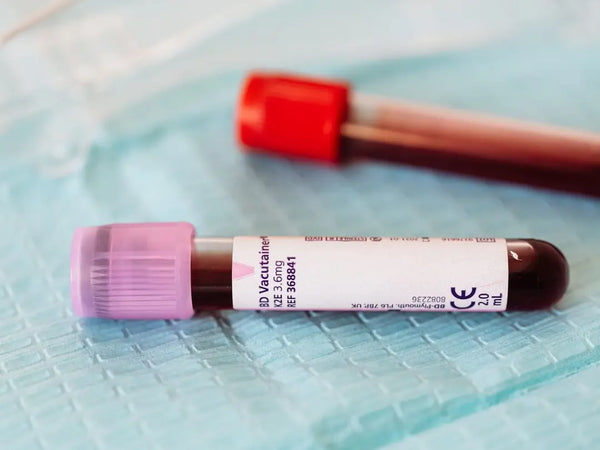 Lyfestyle Metabolic Wellwoman blood test